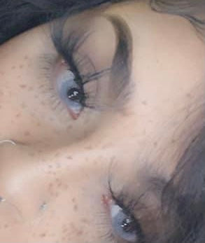 Crystal grey pupilentes